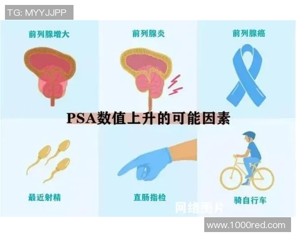 患前列腺癌,前纽卡门将:一年前已承受手术,但癌仍是在分散 患前列腺癌,前纽卡门将:一年前已承受手术,但癌仍是在分散